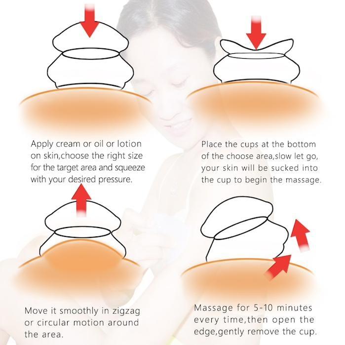 CuppingSet - Effektiv Massage för Hela Kroppen